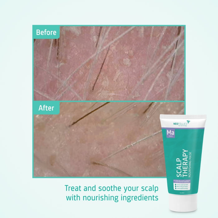 Neofollics nourishing mask