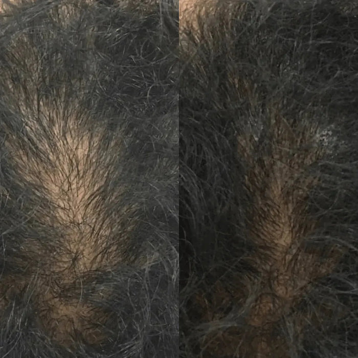Revita tablets for hair growth (1 month) - Hairgivers