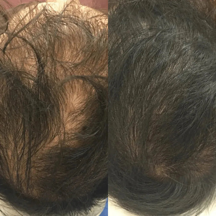 Revita tablets for hair growth (3 months) - Hairgivers